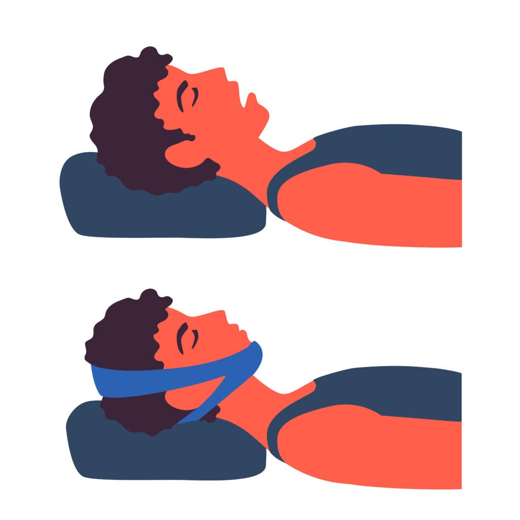 This image shows two illustrations stacked on top of each other. The top illustration shows a man with dark curly hair and a blue shirt sleeping with his mouth open. The second photo shows the same man sleeping with a chinstrap holding his mouth closed.