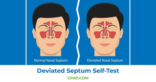 Deviated Septum Self-Test – How To Test at Home for a Deviated Septum