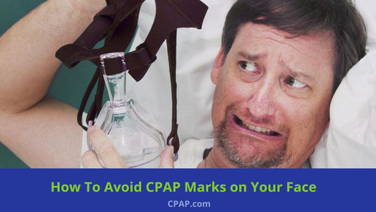 How To Get Rid of Strap Marks and Lines on Your Face From Wearing a CPAP Mask