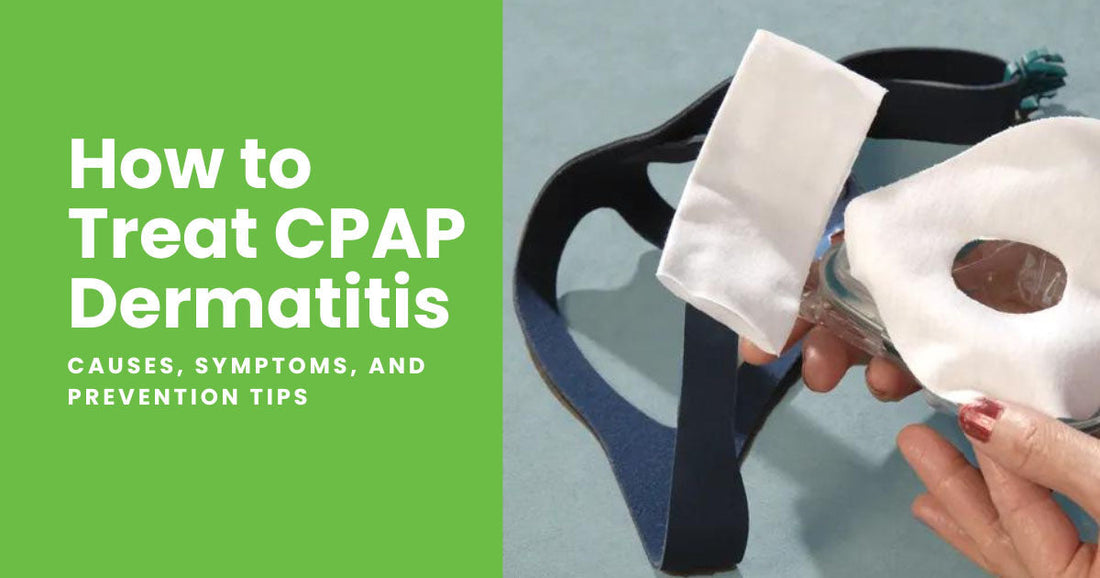 How to Treat CPAP Dermatitis: Common Causes, Treatments, and Prevention Tips