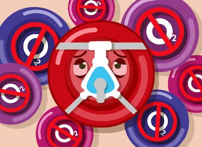 Hypoxia and Hypoxemia: Symptoms, Causes, and Solutions